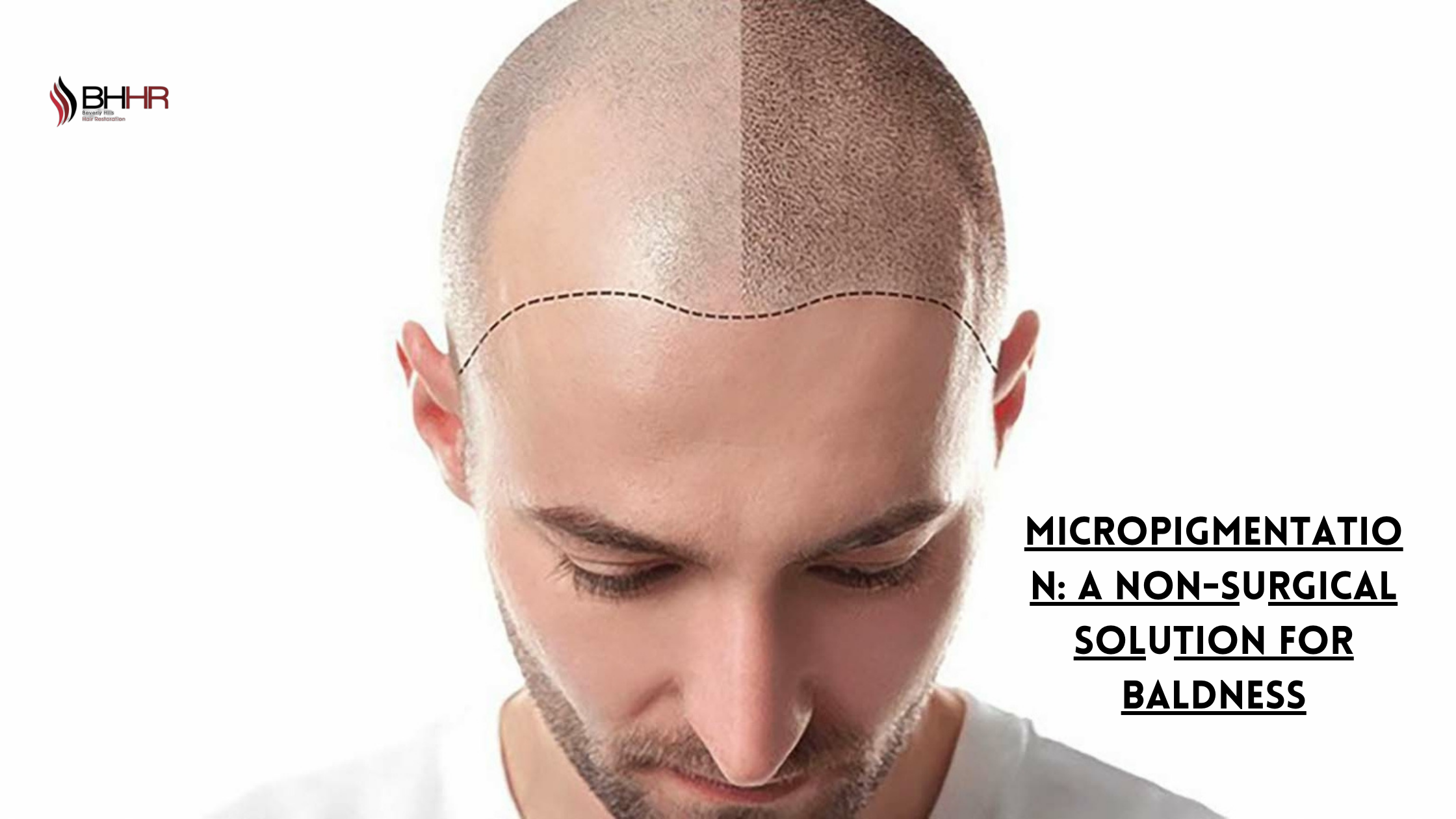 micropigmentation