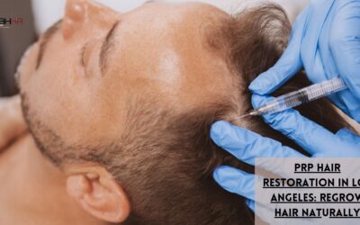 prp hair restoration los angeles